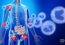 Otulipenia – A New Inflammatory Disease