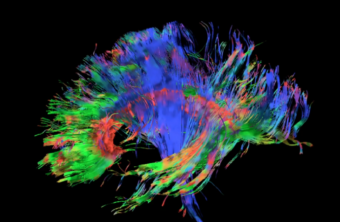 Gene-Mapping The Human Brain