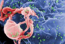 Free of HIV: UK Patient is the Second-Ever in Remission