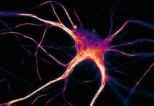 In Alzheimer’s Disease, Faulty Tau Spreads Rapidly But Is Not Toxic at First