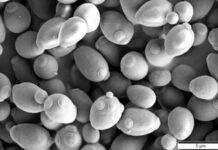 The Strange Case of the Man Who Didn’t Drink Alcohol But Often Appeared Drunk