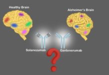 New Insights Treating Rare Type of Alzheimer’s Disease