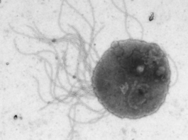 Scientists Developed a Microbe That Synthesizes Complex Molecules From Ambient CO2 Efficiently