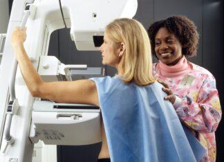 Most women do not link the risk of breast cancer with breast density, a major factor to develop the pathology.